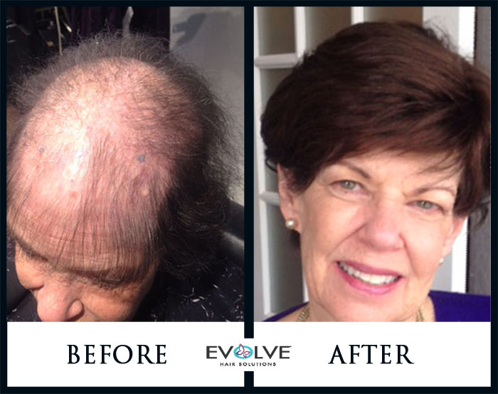 Volumizer, Evolve Hair Solutions